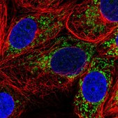 Anti-PC antibody produced in rabbit Prestige Antibodies&#174; Powered by Atlas Antibodies, affinity isolated antibody