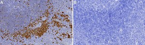 Anti-IRF-4 Antibody, clone 1E10 ZooMAb&#174; Rabbit Monoclonal recombinant, expressed in HEK 293 cells