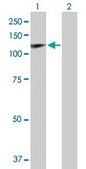 Anti-HIP1 antibody produced in rabbit purified immunoglobulin, buffered aqueous solution