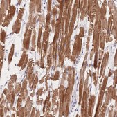 Anti-MYOM1 antibody produced in rabbit Prestige Antibodies&#174; Powered by Atlas Antibodies, affinity isolated antibody, buffered aqueous glycerol solution