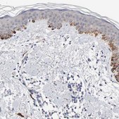 Anti-KIT antibody produced in rabbit affinity isolated antibody, buffered aqueous glycerol solution