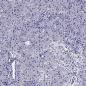Anti-SCARB1 Prestige Antibodies&#174; Powered by Atlas Antibodies, affinity isolated antibody