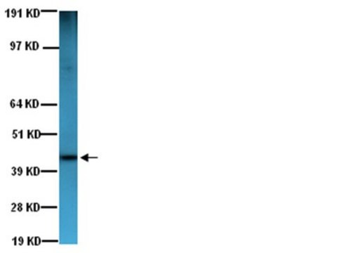 Anti-Actin Antibody, smooth muscle, clone ASM-1 clone ASM-1, Chemicon&#174;, from mouse