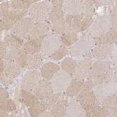 Anti-ISLR antibody produced in rabbit Prestige Antibodies&#174; Powered by Atlas Antibodies, affinity isolated antibody, buffered aqueous glycerol solution