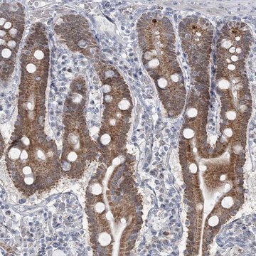 Anti-MTG1 antibody produced in rabbit Prestige Antibodies&#174; Powered by Atlas Antibodies, affinity isolated antibody, buffered aqueous glycerol solution