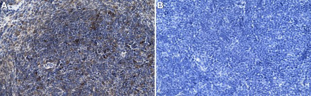 Anti-Ly-6C1 Antibody, clone 2H5 ZooMAb&#174; Rabbit Monoclonal recombinant, expressed in HEK 293 cells