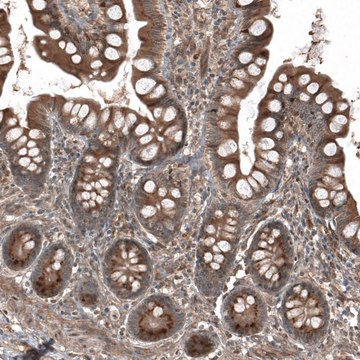 Anti-HMGCR antibody produced in rabbit Prestige Antibodies&#174; Powered by Atlas Antibodies, affinity isolated antibody, buffered aqueous glycerol solution