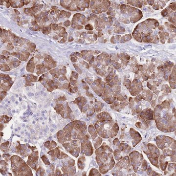 Anti-DET1 antibody produced in rabbit Prestige Antibodies&#174; Powered by Atlas Antibodies, affinity isolated antibody, buffered aqueous glycerol solution