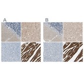 Anti-CACNA2D1 antibody produced in rabbit affinity isolated antibody, buffered aqueous glycerol solution