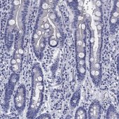 Anti-IGF2BP3 antibody produced in rabbit Prestige Antibodies&#174; Powered by Atlas Antibodies, affinity isolated antibody, buffered aqueous glycerol solution