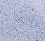 Anti-AIF1/IBA1 (Isoforms 1 and 3) antibody produced in goat affinity isolated antibody, buffered aqueous solution