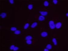 Estrogen Receptor Alpha and STUB1 PLA&#174; Antibody Kit Powered by Bethyl Laboratories, Inc.