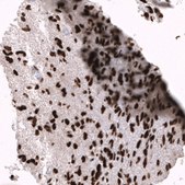 Monoclonal Anti-EZH2 antibody produced in mouse Prestige Antibodies&#174; Powered by Atlas Antibodies, clone CL11915, purified immunoglobulin, buffered aqueous glycerol solution