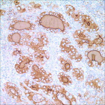 Thyroglobulin (2H11+6E1) Mouse Monoclonal Antibody