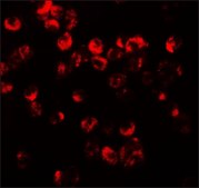 Anti-CXCR3 antibody produced in rabbit affinity isolated antibody