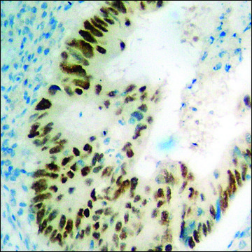 Anti-phospho-p53 (pSer392) antibody produced in rabbit affinity isolated antibody