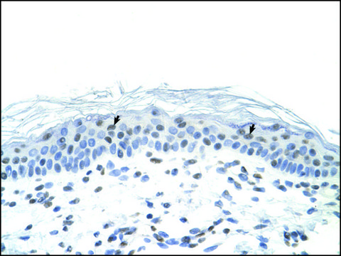 Anti-FOSL1 affinity isolated antibody