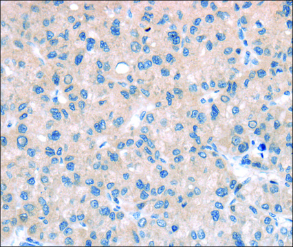Anti-TTI1 affinity isolated antibody