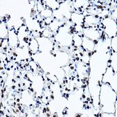 Anti- Twist antibody produced in rabbit
