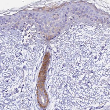 Anti-COL6A5 antibody produced in rabbit Prestige Antibodies&#174; Powered by Atlas Antibodies, affinity isolated antibody, buffered aqueous glycerol solution