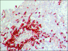 Anti-Human IgG (whole molecule)&#8722;Peroxidase antibody produced in rabbit IgG fraction of antiserum, buffered aqueous solution