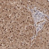 Anti-ITIH4 antibody produced in rabbit Ab1, Prestige Antibodies&#174; Powered by Atlas Antibodies, affinity isolated antibody, buffered aqueous glycerol solution