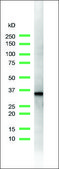 Anti-Cyclin D1 antibody, Rabbit monoclonal clone SP4, recombinant, expressed in proprietary host, tissue culture supernatant