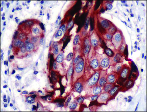 Anti-E-Cadherin antibody, Rabbit monoclonal clone SP64, recombinant, expressed in proprietary host, affinity isolated antibody