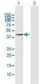Anti-ALLC antibody produced in rabbit purified immunoglobulin, buffered aqueous solution