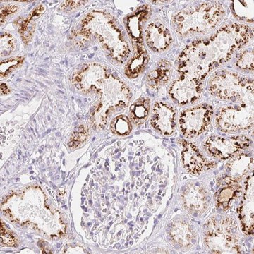 Anti-SCPEP1 antibody produced in rabbit Prestige Antibodies&#174; Powered by Atlas Antibodies, affinity isolated antibody, buffered aqueous glycerol solution