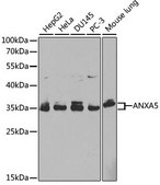 Anti-ANXA5 antibody produced in rabbit