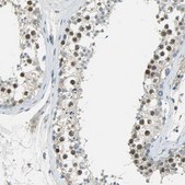 Anti-TPX2 antibody produced in rabbit Prestige Antibodies&#174; Powered by Atlas Antibodies, affinity isolated antibody, buffered aqueous glycerol solution