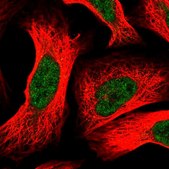 Anti-DDB1 antibody produced in rabbit Prestige Antibodies&#174; Powered by Atlas Antibodies, affinity isolated antibody, buffered aqueous glycerol solution