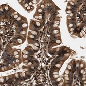 Anti-SAMD9 antibody produced in rabbit Prestige Antibodies&#174; Powered by Atlas Antibodies, affinity isolated antibody, buffered aqueous glycerol solution, Ab2
