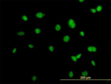 Monoclonal Anti-ACTN4 antibody produced in mouse clone 4D10, purified immunoglobulin, buffered aqueous solution