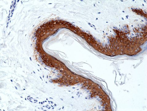 Anti-CK10 (Cytokeratin-10) Rabbit Monoclonal Antibody clone RM386, purified immunoglobulin