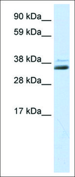 Anti-SFRP1 antibody produced in rabbit IgG fraction of antiserum