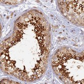 Anti-WDR62 antibody produced in rabbit Prestige Antibodies&#174; Powered by Atlas Antibodies, affinity isolated antibody, buffered aqueous glycerol solution