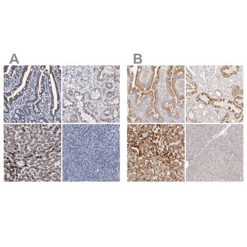 Anti-ACOX1 antibody produced in rabbit Prestige Antibodies&#174; Powered by Atlas Antibodies, affinity isolated antibody, buffered aqueous glycerol solution, Ab2