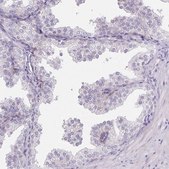 Anti-HSD17B3 antibody produced in rabbit Prestige Antibodies&#174; Powered by Atlas Antibodies, affinity isolated antibody, buffered aqueous glycerol solution