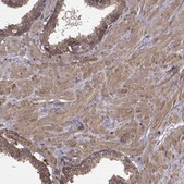 Anti-PPP1R12A antibody produced in rabbit Prestige Antibodies&#174; Powered by Atlas Antibodies, affinity isolated antibody