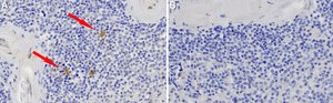 Anti-IL-6R Antibody, clone 1D19 ZooMAb&#174; Rabbit Monoclonal recombinant, expressed in HEK 293 cells
