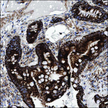 Anti-TET1 antibody produced in rabbit Prestige Antibodies&#174; Powered by Atlas Antibodies, affinity isolated antibody, buffered aqueous glycerol solution