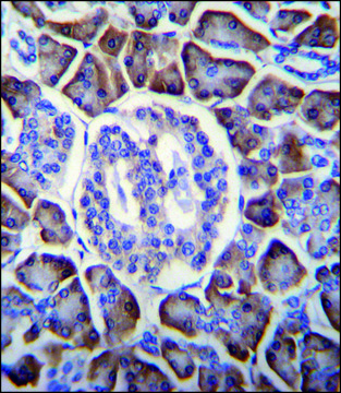 ANTI-GDPD1 (N-TERM) antibody produced in rabbit IgG fraction of antiserum, buffered aqueous solution