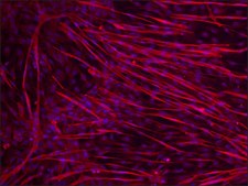 Anti-Dysferlin (N-terminal) antibody produced in rabbit ~1.0&#160;mg/mL, affinity isolated antibody, antigen mol wt ~250&#160;kDa
