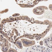 Anti-BIRC5 antibody produced in rabbit Prestige Antibodies&#174; Powered by Atlas Antibodies, affinity isolated antibody, buffered aqueous glycerol solution