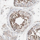 Anti-FAAH antibody produced in rabbit Prestige Antibodies&#174; Powered by Atlas Antibodies, affinity isolated antibody, buffered aqueous glycerol solution