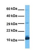 Anti-FABP4 antibody produced in rabbit affinity isolated antibody