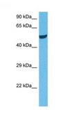 Anti-CALCRL antibody produced in rabbit affinity isolated antibody