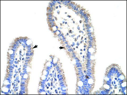 Anti-METTL3 (AB2) antibody produced in rabbit IgG fraction of antiserum